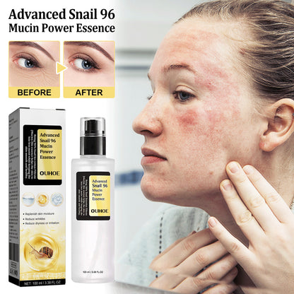 Advanced Snail Skin Repair Serum
