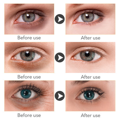 Retional Anti Aging Eye Cream