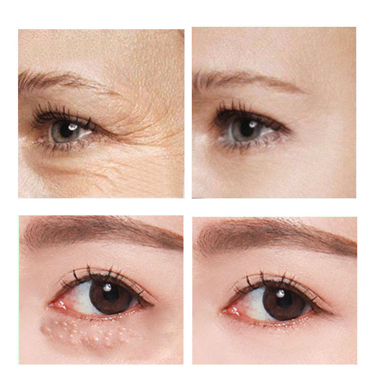 Retional Anti Aging Eye Cream